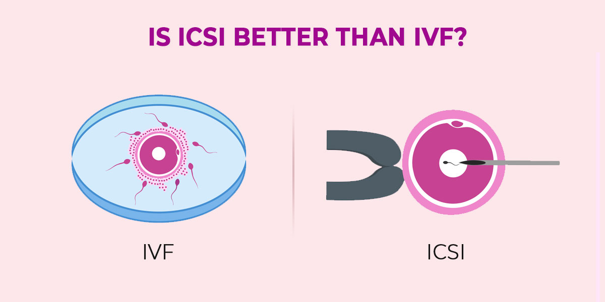 Is ICSI better than IVF?