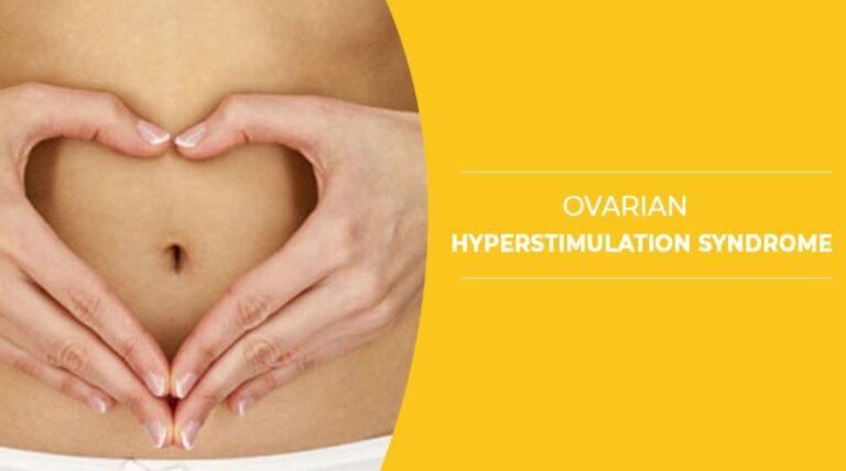 Ovarian Hyperstimulation Syndrome