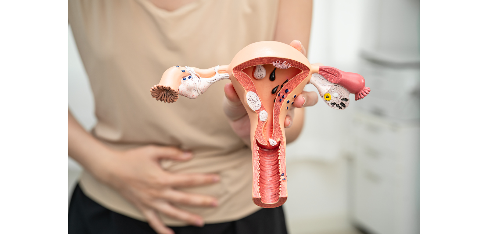 What is Vaginismus: Causes, Symptoms & Treatments